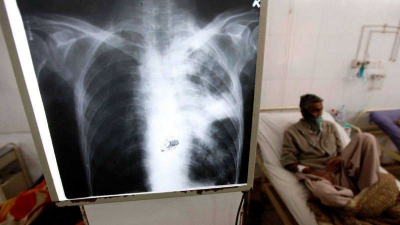 Día Mundial de la Tuberculosis