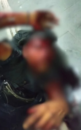 Hombre-fuertemente-golpeado_edit_100444711675587