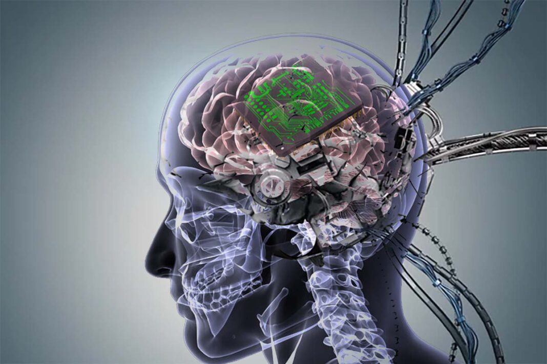 cerebral